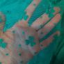 Girl's St. Patricks outfit Image 5