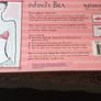 Infinity bra and silicone self adhesive bra Image 3
