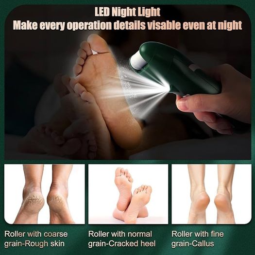 NEW SALE | Foot File Feet Hard Skin Remover, Professional Callus Remover Foot Grinder Pedicure Foot Care Utensil Cutters Accessories for Dead Skin Dry Skin, USB Rechargeable with 3 Replacement Rollers