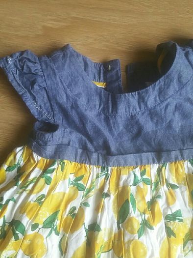 baby dress