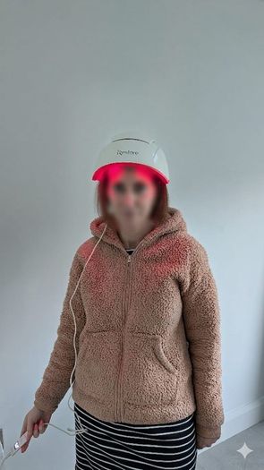 Red Light iRestore Hair Helmet