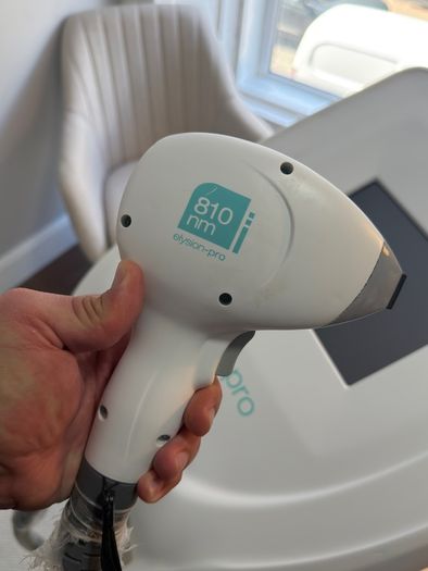 laser hair removal