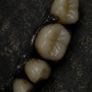 Resin Teeth and Molten Metal Oddity Ear Hoops Image 5