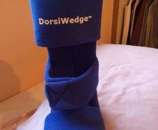 Dorsiwedge night splint for plantar fasciitis
