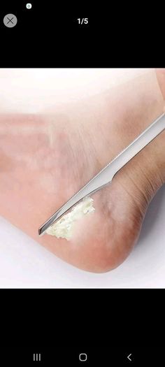 Foot pedicure