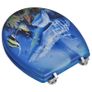 Toilet Seats with Lids 2 pcs MDF Dolphin Image 6