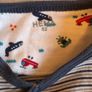 14 Footless baby grows. Image 3