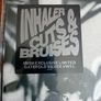 Inhaler Ireland Edition Cuts & Bruises vinyl Image 5