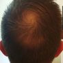 Toppik Hair Building Fibres 27.5g Image 5