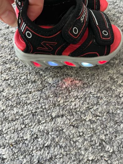 Sketchers lights