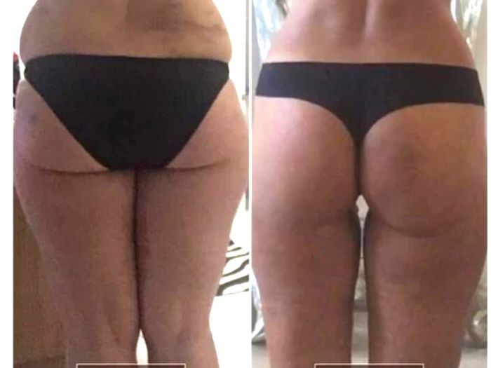 Excellent Proven FASCIA RELEASE Tools - Ashley Black