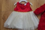 baby dress