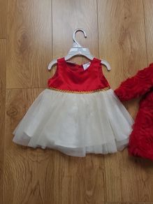 baby dress