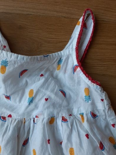 baby dress