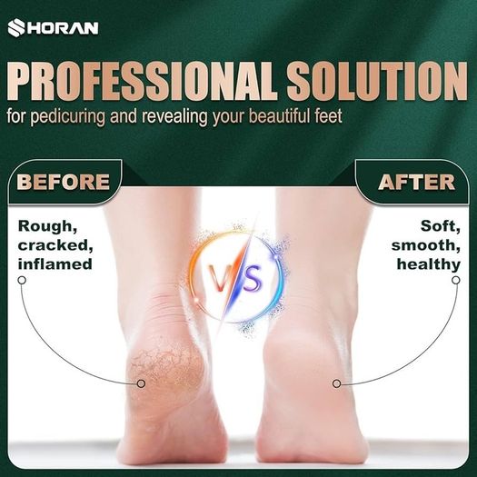 NEW SALE | Foot File Feet Hard Skin Remover, Professional Callus Remover Foot Grinder Pedicure Foot Care Utensil Cutters Accessories for Dead Skin Dry Skin, USB Rechargeable with 3 Replacement Rollers
