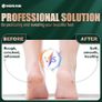 NEW SALE | Foot File Feet Hard Skin Remover, Professional Callus Remover Foot Grinder Pedicure Foot Care Utensil Cutters Accessories for Dead Skin Dry Skin, USB Rechargeable with 3 Replacement Rollers Image 5