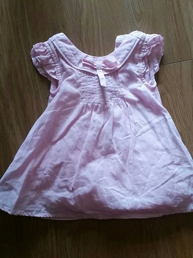 baby dress