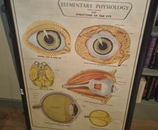 Large Framed Medial Illustration
