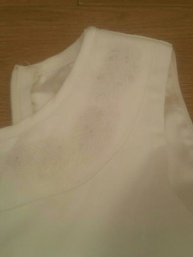 baby dress