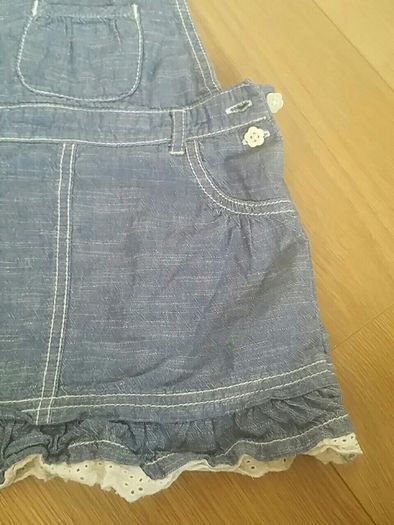 baby dress