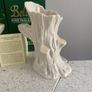 Belleek Vases Image 5
