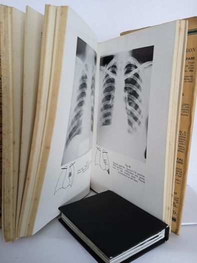 Pulmonary Tuberculosis: A Handbook For Students and Practitioners by R. Y. Keers and B. G. Rigden (HQ555)