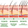 Pure Rosemary Essential Oil for Hair Growth, Skin Care (30ml) Image 2