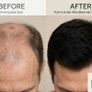 Hair fibre  concealer products Image 3