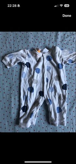 14 Footless baby grows.