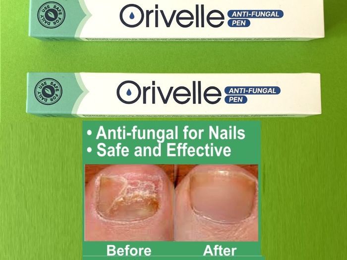Fungal Nail - Care and Repair