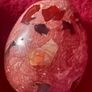 stone eggs Image 3