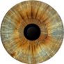 Iris Health Analysis Image 6