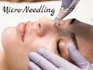 Dermaplaning Image 5
