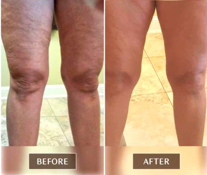 Excellent Proven FASCIA RELEASE Tools - Ashley Black