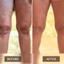 Excellent Proven FASCIA RELEASE Tools - Ashley Black Image 3
