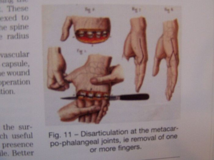 Men Of Steel (Surgery in the Napoleonic Wars) - Medical History Book - Military History Book - Napoleonic War History Book