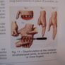 Men Of Steel (Surgery in the Napoleonic Wars) - Medical History Book - Military History Book - Napoleonic War History Book Image 5