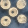 Vintage 50's/60's Set of 5 Opaque Glass Shades with Motif Design. Image 2