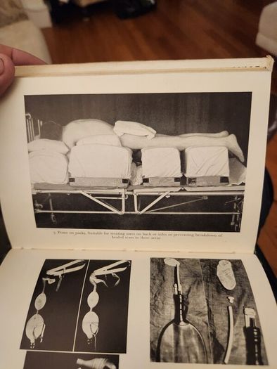 Understanding Paraplegia. By J.j. Walsh. First Edition. 1964. Hardback In Good Condition.