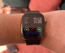 Apple Watch Gold Series 10 GPS + Cellular