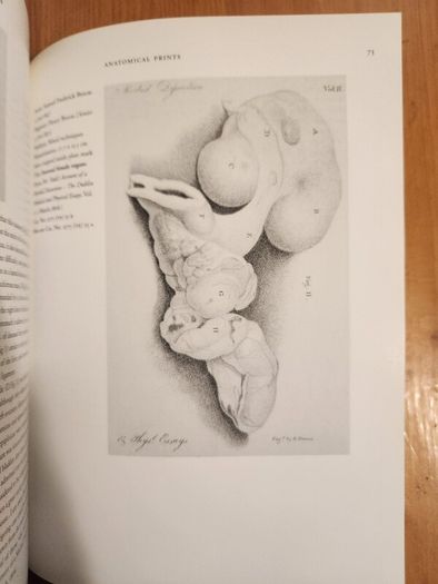 The Brocas Collection. An Illustrated Selective Catalogue 0f Original Watercolours, Prints, And Drawings In The National Museum Of Ireland.  By Patricia Butler. First Edition Large Volume Paperback In Good Condition.