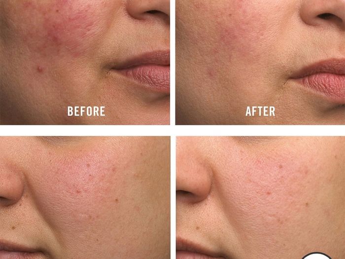 First Aid Beauty Ultra Repair Cream (396.8g) biggest jar