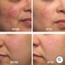 First Aid Beauty Ultra Repair Cream (396.8g) biggest jar Image 8