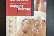 Traditional Chinese Medicine: Cupping Therapy by Ilkay Zihni Chirali: