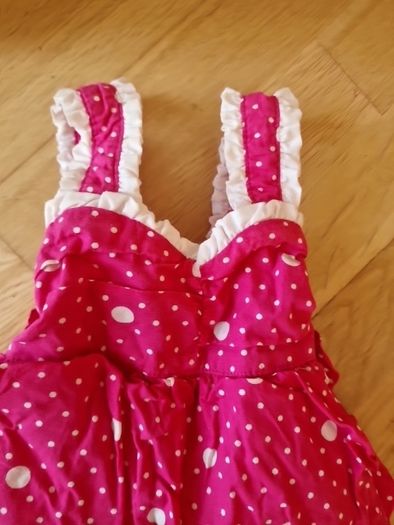 baby dress