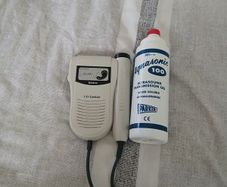 fetal doppler