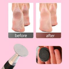 Foot File Callus Remover Replacement Sandpaper Disc Easy To Remove Cutin Dead Skin Calluses