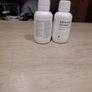 hairloss Image 3