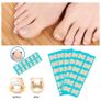 Brand New Toenail Patch, Ingrown Toenail, Toenail Correction, Image 4