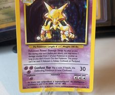 Alkazam Base Set Pokemon Card